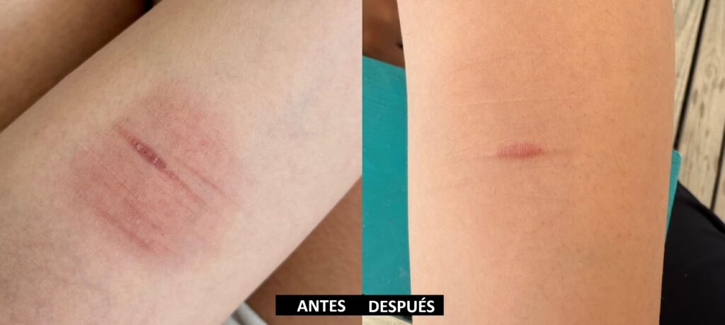 IMG_CICATRIZx
